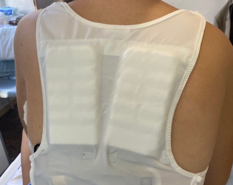 Un chaleco desfibrilador portátil para evitar la muerte súbita de una joven valenciana