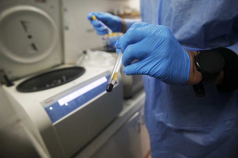 VIH Comunitat Valenciana