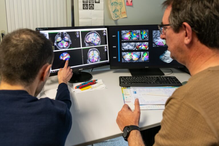 La UPV impulsa el diagnóstico e investigación de la epilepsia con IA